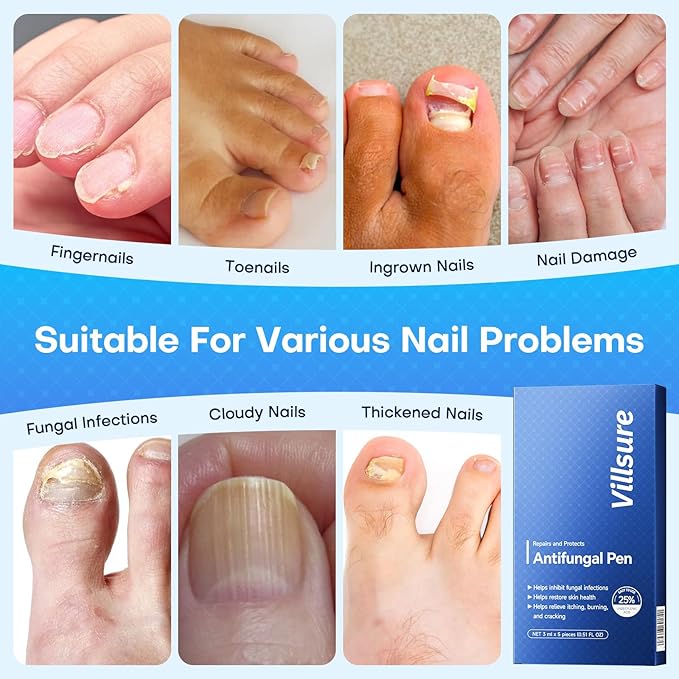 Villsure Toenail Fungus Pen
