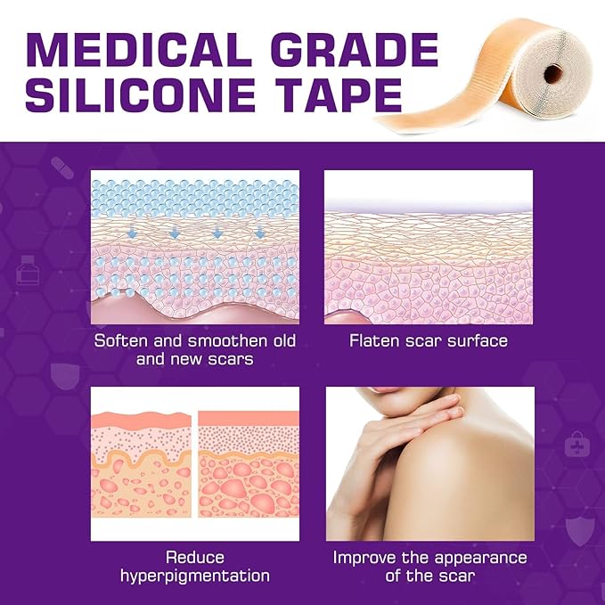 Silicone Scar Tape