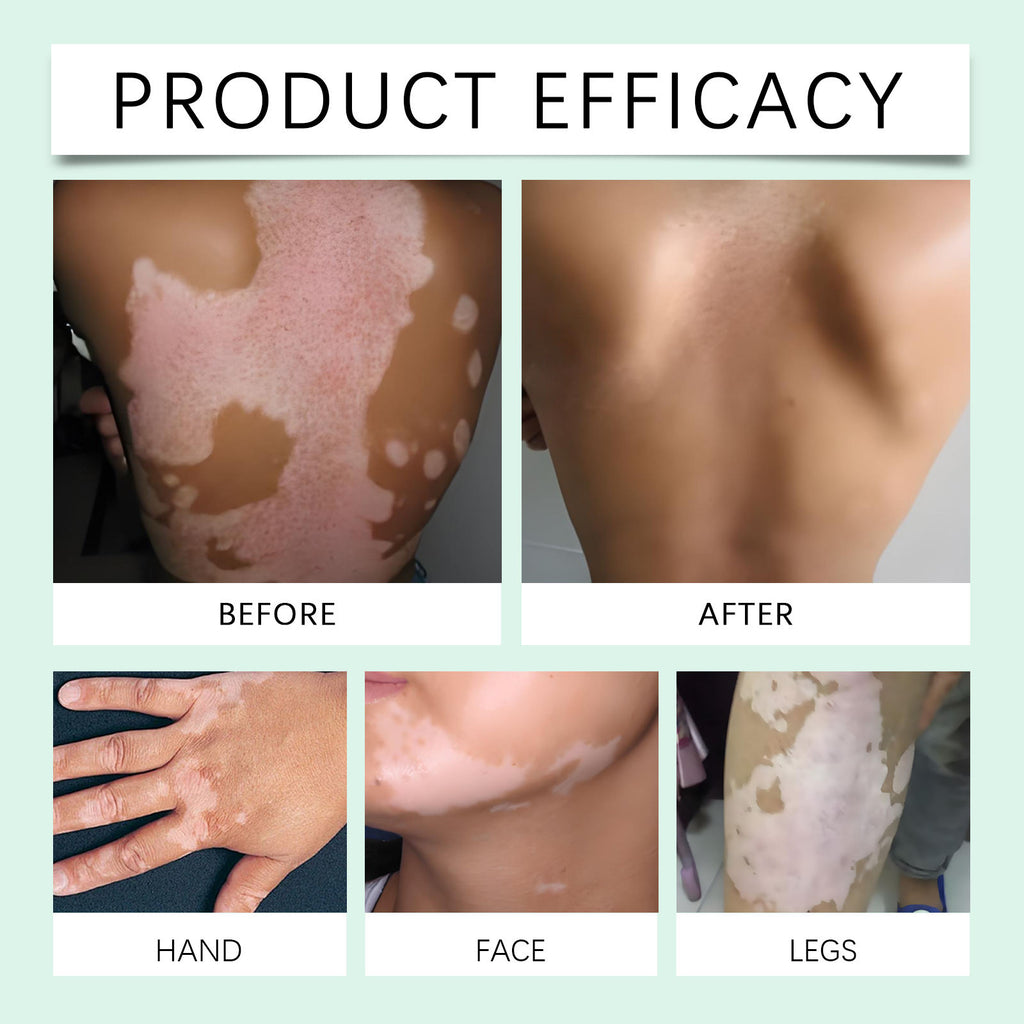 Care Cream With Aloe Vera
